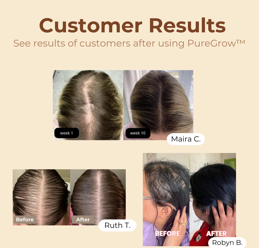 1+1 GRATIS | PureGrow™ Organic Batana Oil